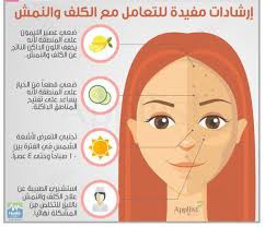 ارشادات للتعامل مع الكلف والنمش Skin البشره نمش كلف Freckle Costs Hair Up Styles My Beauty Beauty Hacks