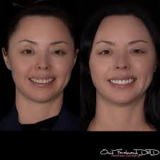 Focus Dental Group Alhambra, CA