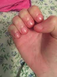 Maybe you would like to learn more about one of these? Stubby Nails And Fake Nails Beautylish