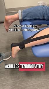 Image result for Taping for Soleus and Achilles
