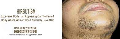 It is slightly more popular than comparable drugs. What Is Hirsutism Trichology Centre Toronto