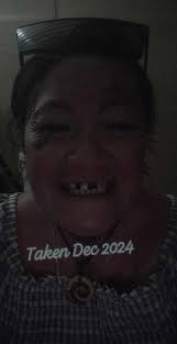 Wow what a whirlwind journey it's been, sure has been a long one thats for  sure.... My advice is to look after ya teeth, brush