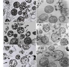 We did not find results for: Ultrastructural Changes In Mitochondria And Peroxisomes From Pisum Download Scientific Diagram