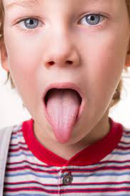 Know How To Recognize Food Allergy Symptoms