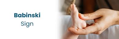 Image result for Babinski Reflex