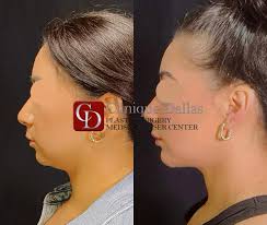 Clinique Dallas Plastic Surgery