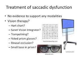 Visual Complaints After Concussion Ppt Download