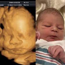 Babyvision Ultrasound 31 Photos 48 Reviews Diagnostic Imaging 754 Nw Lp 410 San Antonio Tx Phone Number