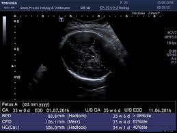 27 ssw 3d / 4d ultraschall ; Praxis Veltmann Heinig Schwangerschaft