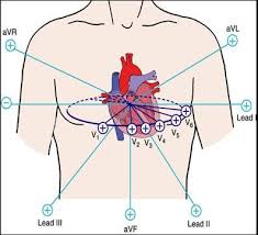 The Ultimate 12 Lead Ecg Placement Guide With Illustrations