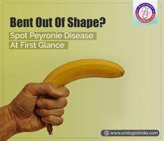 9 Best Peyronie S Disease Ideas In 2021 Peyronies Disease Disease Treatment