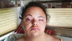 Fundraiser for Yolanda Lovelace by Lynne Funcheon : Help Mychael with  medical and moving expenses