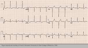 Nestiind exact ce presupun cele doua (mai ales prima, avand o oarecare idee. Durerea De Cap Cefaleea Clinica De Cardiologie Cardioclass