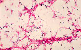 Coli , group b streptococci, staphylococci listeria , borrelia burgdorferi (lyme disease), tb and fungi. Pneumococcal Disease Photos Cdc