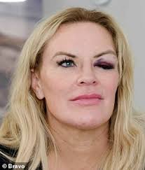 Whitney Rose denies giving her cousin Heather Gay a black eye