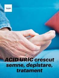 Tratament medicamentos sau interventii recomandate pentru transpiratia excesiva. 540 Sanatate Remedii Naturiste Ideas In 2021 Remedii Naturiste SÄƒnÄƒtate Remedii Naturale