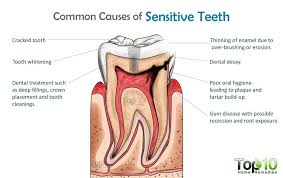 How To Relieve Tooth Sensitivity Home Remedies And Tips Top 10 Home Remedies Tooth Sensitivity Sensitive Teeth Remedy Sensitive Teeth