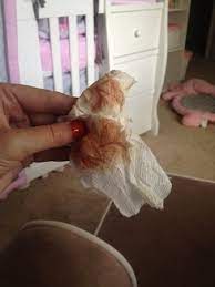 Just Got Cervix Checked No Bleeding Pic Babycenter