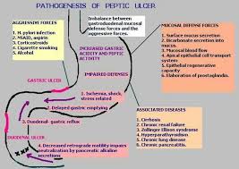Pud Peptic Ulcer Disease Peptic Ulcer Nursing