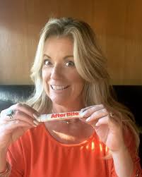 This has been a big part of this summer, lol 🦟 Not sure if it really  works, but it takes the edge off, lol. Do you have an itch remedy? Samantha