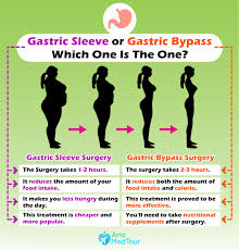 Gastric sleeve surgery before and after selfies post your pictures share. Gastric Bypass Vs Gastric Sleeve A Close Comparison Ariamedtour