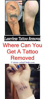 Tattoo removal aftermath how many sessions to completely remove tattoo can a new tattoo be re tattoo removal cost tattoo removal the health of the person influences how long laser tattoo removal takes. Tattoo Removal Sessions How Much Does Laser Tattoo Removal Hurt Tattoo Removal Jobs Tattoo Removal Tattoo Removal Cost Tattoo Removal Eyebrow Tattoo Removal
