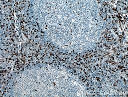 Ccr5 promoter polymorphisms associated with pulmonary tuberculosis in a chinese han the combination of cc chemokine receptor type 5(ccr5) and treg cells predicts prognosis in patients. Ccr5 Antibody 17476 1 Ap Proteintech