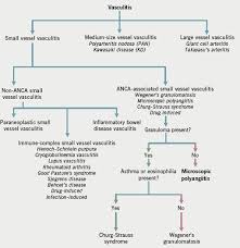 Image result for Microscopic Polyangiitis