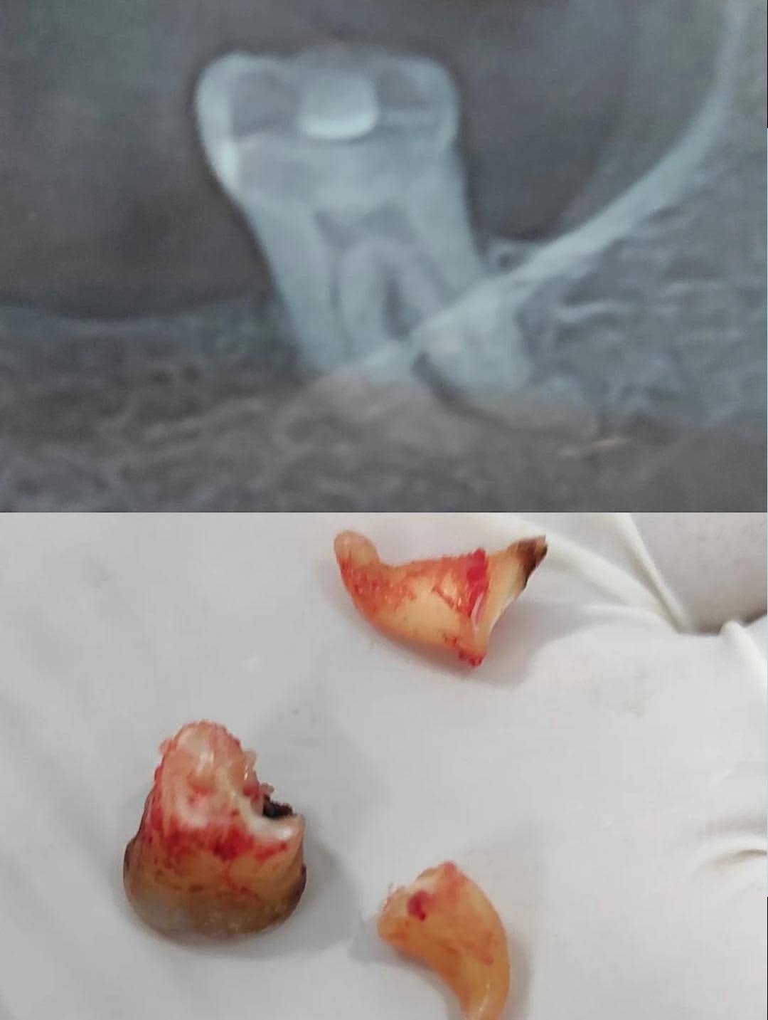 Extraction product image