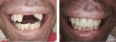 Check spelling or type a new query. Happy Dental Geelong West Gentle Caring Andd Quality Dentistry