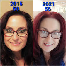 Saggy skin around mouth and smile lines?