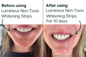 Some of our products require application twice a day, but most do not. Lumineux Non Toxic Teeth Whitening Strips Review Umbel Organics Umbel Organics