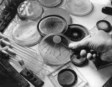 Las penicilinas son antibióticos del grupo de los betalactámicos empleados profusamente en el tratamiento de infecciones provocadas por bacterias sensibles. The Real Story Behind Penicillin Pbs Newshour