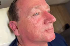 Lorry driver ages dramatically