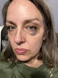 Any other Golden's insist