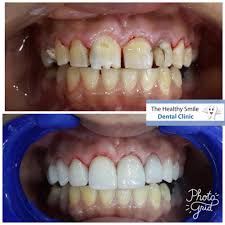 Please fill out the below form to start a conversation with us. The Healthy Smile Home Facebook