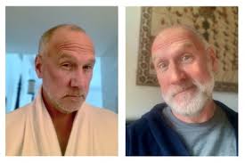 A deficiency in this vitamin can even weaken your facial hair, resulting in patchy or slow beard growth. How The Beard Club Helped Me Grow A Beard The Manual