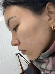 What moisturizer is suitable for combination skin with dryness around the  nose and lips?