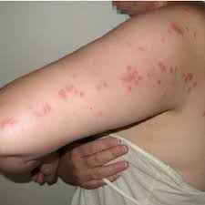 There are some know cockroach predators that can help you keep off those chemical roach killers and also cut on the pest control costs. Pdf Bed Bugs Clinical Relevance And Control Options