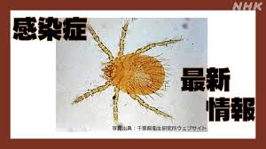新型コロナ インフルエンザ ツツガムシ 感染症流行状況は 千葉 | NHK