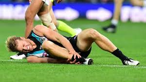 A utility, 1.96 metres (6 ft 5 in) tall and weighing 93 kilograms (205 lb), watts played in any position on the ground and has played for extended periods of time as a forward, defender. Port Adelaide Confirm Jack Watts Leg Break