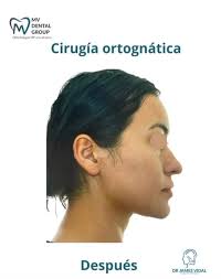 Un antes y después que habla por sí solo., La cirugía ortognática no solo  transforma sonrisas, también cambia vidas., Agenda tu cita