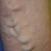 Tahicardie, tartu (piatra dentară), tendinita, tendinita achileană, tenosinovita, mai multe tetanosul, tifilita, tifosul, tiroidita, tirozinemie. Https Encrypted Tbn0 Gstatic Com Images Q Tbn And9gcttgtmxd Cdwtkhaupj0enc14fqmv1o3eeatgvst1lmds4imu9l Usqp Cau