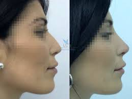 Dr. Maximo Alejandro Evia Arceo