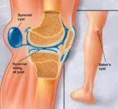 Pin On Health