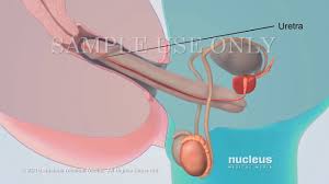 Analisis De Semen Cantidad De Esperma Youtube