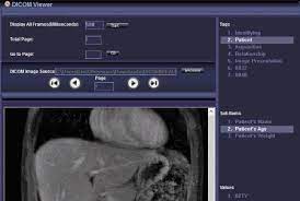 Imagej is a featured image analysis software for windows. 12 Best Free Windows Dicom Viewer Softwares Wpshopmart