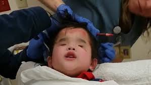 Music therapist helps little girl stay clam through EEG scan