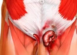 Maybe you would like to learn more about one of these? Hernia InghinalÄƒ ScrotalÄƒ Cauze Simptome Diagnostic Tratament Competent Despre SÄƒnÄƒtate Pe Ilive