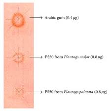 Image result for Plantago palmata